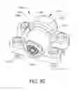 Fig. 86 - Adjustable implant and method of use