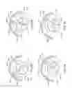 Fig. 87 - Adjustable implant and method of use