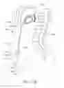 Fig. 99 - Adjustable implant and method of use