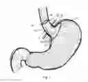 Fig. 02 - Bariatric device and method