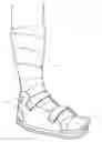 Fig. 01 - Total contact cast