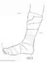 Fig. 06 - Total contact cast