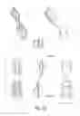 Fig. 17 - Self-activated lifting vest with sensory-feedback and methods of use thereof