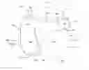 Fig. 01 - Force distribution method and apparatus for neonates at risk of cranial molding