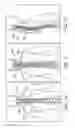 Fig. 07 - INTEGRATED MULTISECTIONAL HEAT EXCHANGER