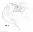 Fig. 02 - Eyedropper with improved stability and method of administering a liquid onto the surface of an eye