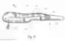 Fig. 06 - Therapeutic medical compression garment and method