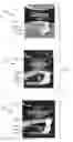 Fig. 01 - SELECTION GUIDE AND ARRAY OF ABSORBENT ARTICLES