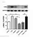 Fig. 06 - METHODS FOR REDUCING ACUTE AXONAL INJURY