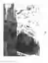 Fig. 08 - Composition and methods for the treatment of peripheral nerve injury