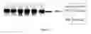 Fig. 08 - Nanocapsules of protamine