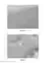 Fig. 02 - Use of 7-a-[9-(4,4,5,5,5-pentafluoropentylsulfinyl)nonyl]-estra-1,3,5(10)- triene-3,17B-diol and derivatives thereof