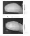 Fig. 04 - METHOD FOR IMPEDING SKIN INFLAMMATORY RESPONSE TO AN ENERGY INJURY