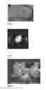 Fig. 02 - OIL BODY EXTRACTION AND USES