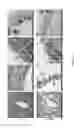 Fig. 06 - Combination of immunotherapies with activators of Tie-2