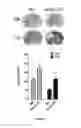 Fig. 10 - Combination of immunotherapies with activators of Tie-2