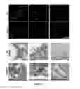 Fig. 19 - Combination of immunotherapies with activators of Tie-2