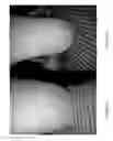 Fig. 02 - Composition and methods for treating skin conditions