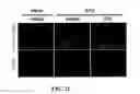 Fig. 22 - Anti-inflammatory pharmaceutical composition comprising benzopyranyl tetracycles