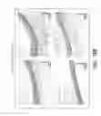 Fig. 24 - Pharmaceutical composition, methods for treating and uses thereof