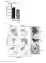 Fig. 35 - Combination therapy for MDS