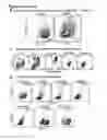 Fig. 17 - Methods and compositions for generating chondrocyte lineage cells and/or cartilage like tissue