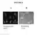 Fig. 06 - Method of isolating cells for therapy and prophylaxis