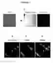 Fig. 07 - Method of isolating cells for therapy and prophylaxis