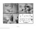 Fig. 07 - Compositions and methods for imaging and treatment