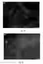 Fig. 06 - Hydrogel precursors having nanoparticles