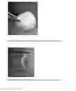 Fig. 06 - Compositions and methods for enhancing healing and regeneration of bone and soft tissue