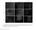Fig. 07 - Compositions and methods for enhancing healing and regeneration of bone and soft tissue