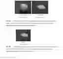 Fig. 08 - Compositions and methods for enhancing healing and regeneration of bone and soft tissue