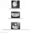 Fig. 09 - Compositions and methods for enhancing healing and regeneration of bone and soft tissue
