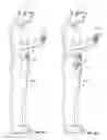 Fig. 05 - Infusion pump assembly and method