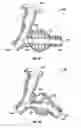 Fig. 24 - Airway adapters and suction catheter systems