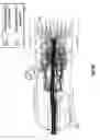Fig. 53 - Airway adapters and suction catheter systems