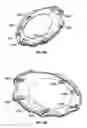 Fig. 62 - Airway adapters and suction catheter systems