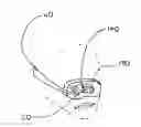 Fig. 01 - STIMMING-REDUCTION VIEWING APERTURE AND METHOD OF USING