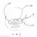 Fig. 02 - STIMMING-REDUCTION VIEWING APERTURE AND METHOD OF USING