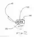Fig. 03 - STIMMING-REDUCTION VIEWING APERTURE AND METHOD OF USING