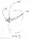 Fig. 06 - STIMMING-REDUCTION VIEWING APERTURE AND METHOD OF USING