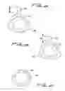 Fig. 03 - DIALYSIS CATHETER