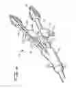 Fig. 05 - DIALYSIS CATHETER