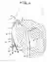 Fig. 07 - DIALYSIS CATHETER