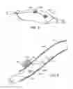 Fig. 05 - METHODS AND SYSTEMS FOR TREATING ISCHEMIC TISSUES