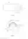 Fig. 03 - CUTTING EDGE CUTTING CATHETER