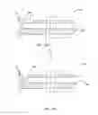 Fig. 04 - CUTTING EDGE CUTTING CATHETER