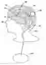 Fig. 01 - Shunt flusher