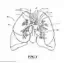 Fig. 02 - Systems, devices, and methods for treating a pulmonary disorder with an agent